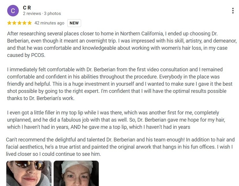 Dr. Rob Berberian VIP FUE Hair Transplant Los Angeles & Newport Beach Reviews Dr. Rob Berberian VIP FUE Hair Transplant Los Angeles & Newport Beach Reviews